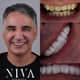 Slider image (10) Best Dental Clinic in Istanbul - Niva Aesthetic